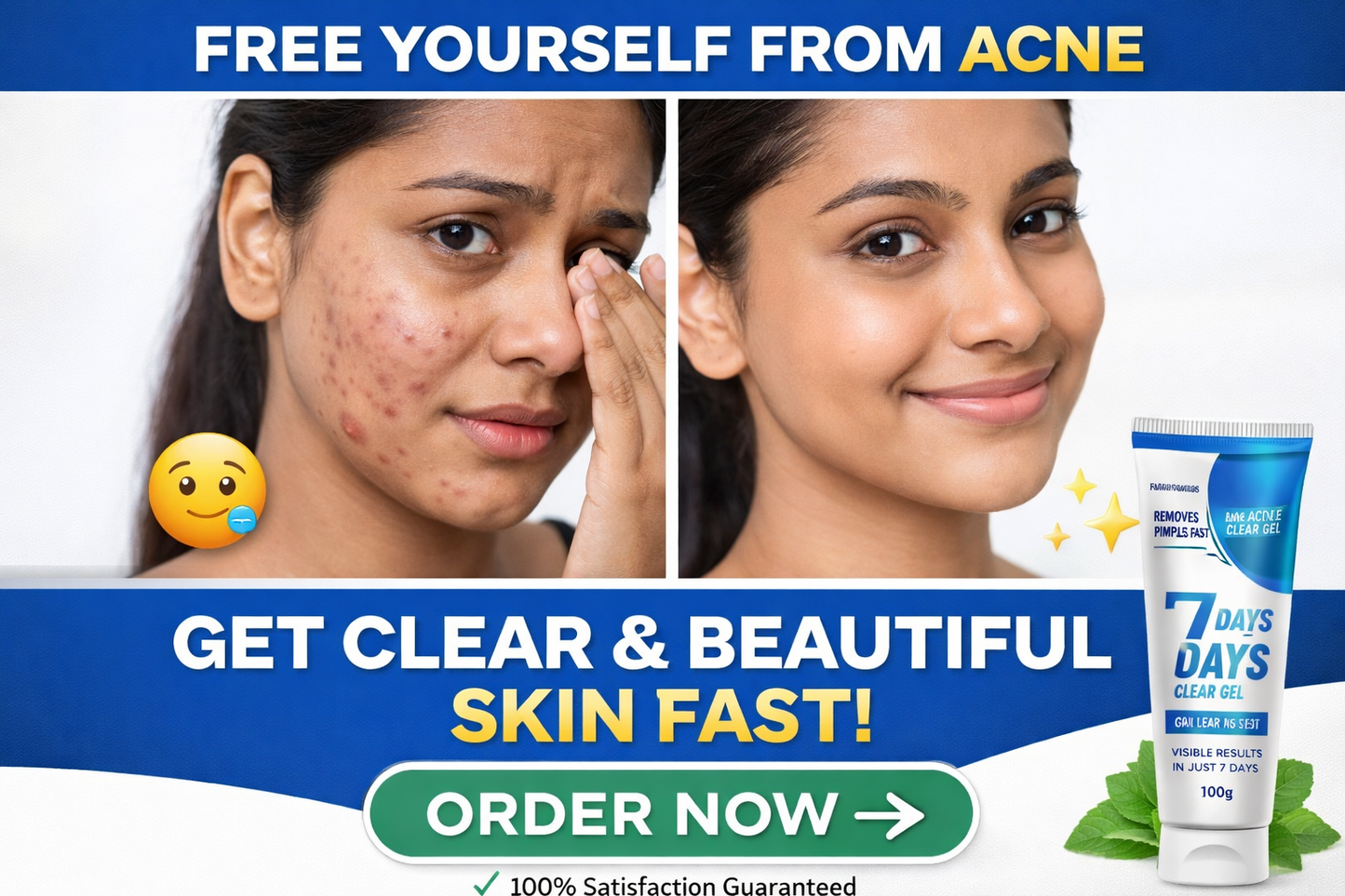 🌿 Clear Skin in 7 Days | Acne Removal Gel
